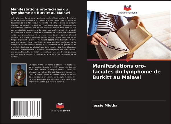 Produktbild: Manifestations oro-faciales du lymphome de Burkitt au Malawi