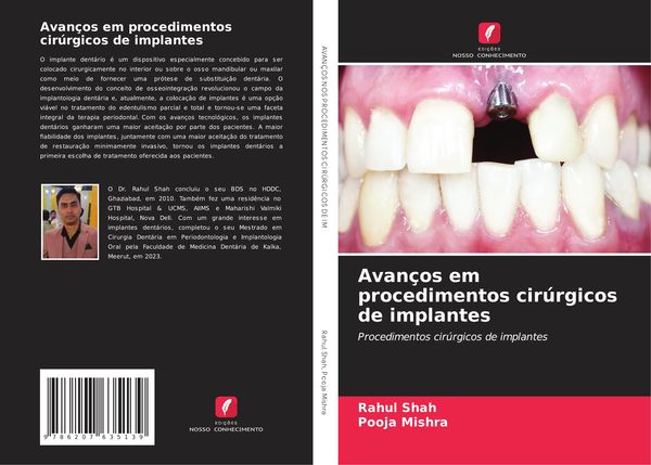 Produktbild: Avan&ccedil;os em procedimentos cir&uacute;rgicos de implantes