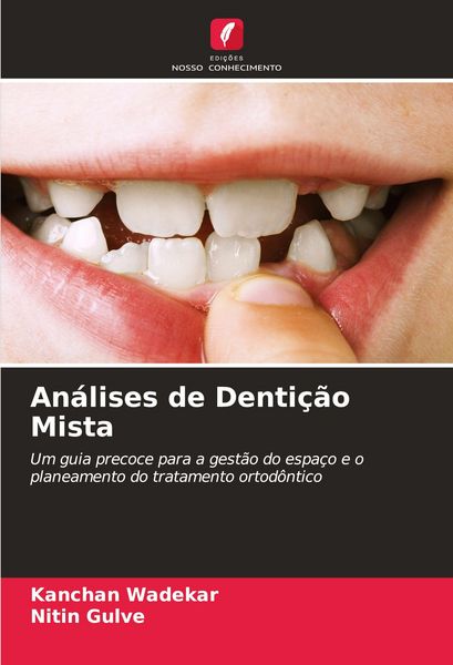 Produktbild: An&aacute;lises de Denti&ccedil;&atilde;o Mista