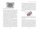 Thumbnail-14