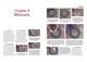 Thumbnail-15