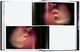 Thumbnail-7