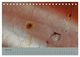 Thumbnail-11