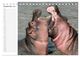 Thumbnail-14
