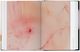 Thumbnail-10