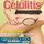Artikelbild von Celulitis