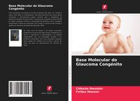 Produktbild: Base Molecular do Glaucoma Cong&eacute;nito