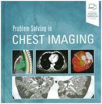 Produktbild: Problem Solving in Chest Imaging