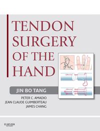 Produktbild: Tendon Surgery of the Hand E-Book