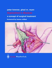 Produktbild: Dupuytren&rsquo;s Disease
