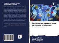 Produktbild: Sindrom polikistoznyh qichnikow u zhenschin