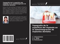 Produktbild: Topograf&iacute;a de la superficie del implante en la osteointegraci&oacute;n de implantes dentales