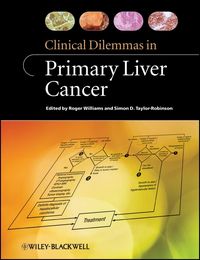 Produktbild: Clinical Dilemmas in Primary Liver Cancer