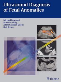 Produktbild: Ultrasound Diagnosis of Fetal Anomalies