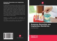 Produktbild: Avan&ccedil;os Recentes em Implantes Dent&aacute;rios