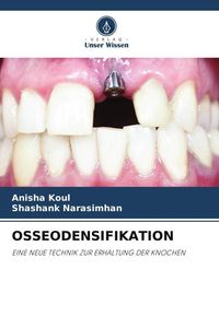 Produktbild: Osseodensifikation