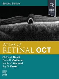 Produktbild: Atlas of Retinal OCT E-Book