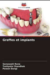 Produktbild: Greffes et implants