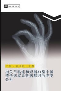 Produktbild: zhi guan jie zhan lian he duan zhi A1 xing zhong guo yi chuan bing jia xi zhi bing ji yin de tu bian fen xi