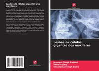 Produktbild: Les&otilde;es de c&eacute;lulas gigantes dos maxilares