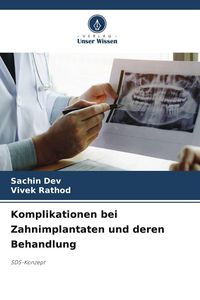 Produktbild: Komplikationen bei Zahnimplantaten und deren Behandlung