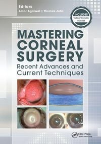 Produktbild: Mastering Corneal Surgery