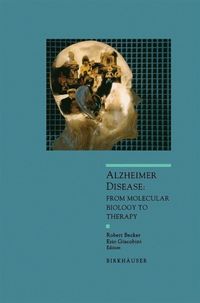 Produktbild: Alzheimer Disease