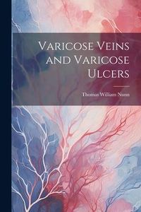 Produktbild: Varicose Veins and Varicose Ulcers