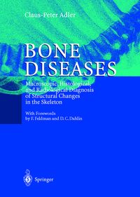 Produktbild: Bone Diseases