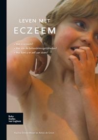 Produktbild: Leven met eczeem