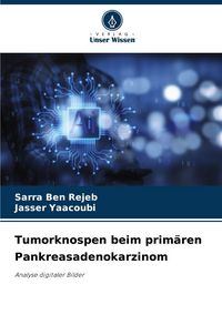 Produktbild: Tumorknospen beim prim&auml;ren Pankreasadenokarzinom