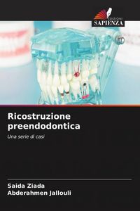 Produktbild: Ricostruzione preendodontica