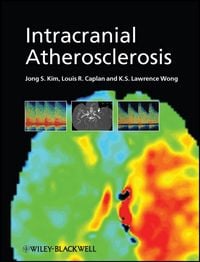 Produktbild: Intracranial Atherosclerosis