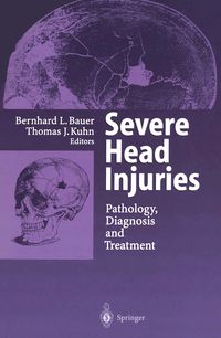 Produktbild: Severe Head Injuries