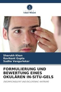 Produktbild: Formulierung und Bewertung Eines Okul&auml;ren in-Situ-Gels
