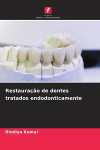 Produktbild: Restaura&ccedil;&atilde;o de dentes tratados endodonticamente