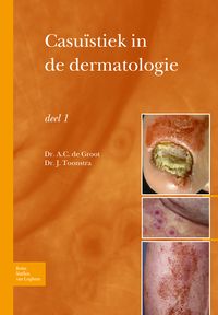 Produktbild: Casu&iuml;stiek in de dermatologie - deel I