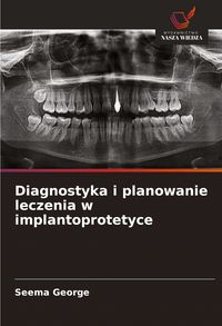 Produktbild: Diagnostyka i planowanie leczenia w implantoprotetyce