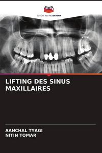Produktbild: Lifting des Sinus Maxillaires