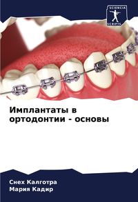 Produktbild: Implantaty w ortodontii - osnowy