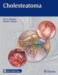 Produktbild: Cholesteatoma