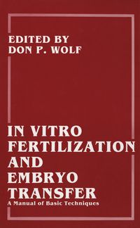 Produktbild: In Vitro Fertilization and Embryo Transfer