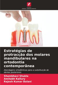 Produktbild: Estrat&eacute;gias de protrac&ccedil;&atilde;o dos molares mandibulares na ortodontia contempor&acirc;nea