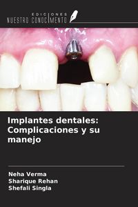 Produktbild: Implantes dentales: Complicaciones y su manejo