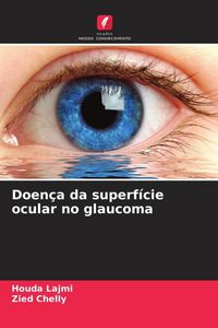 Produktbild: Doen&ccedil;a da superf&iacute;cie ocular no glaucoma