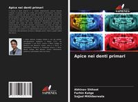 Produktbild: Apice nei denti primari
