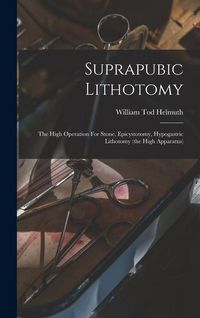 Produktbild: Suprapubic Lithotomy: The High Operation For Stone, Epicystotomy, Hypogastric Lithotomy (the High Apparatus)