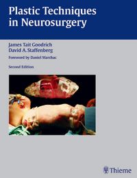 Produktbild: Plastic Techniques in Neurosurgery
