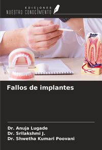 Produktbild: Fallos de implantes