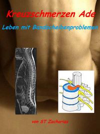 Produktbild: Kreuzschmerzen ade